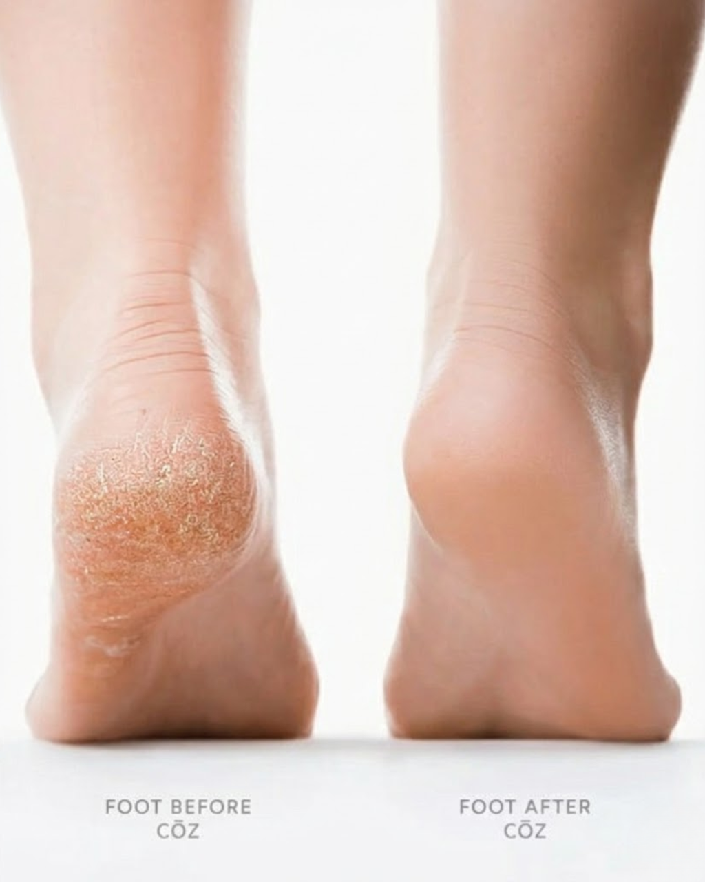 CŌZ Silk 3 Pro 🇩🇰